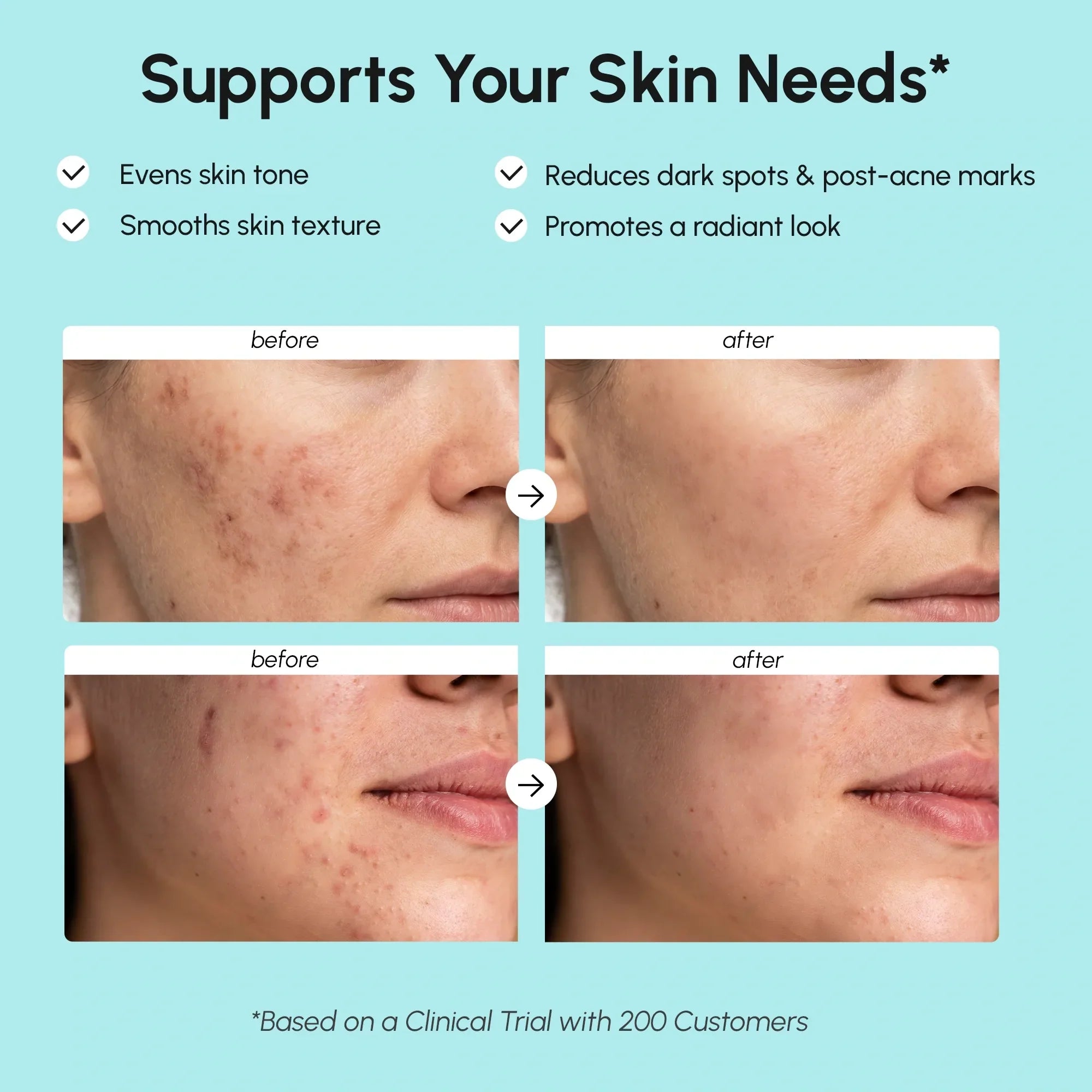 Maree Azelaic Acid Cream for sensitive skin, featuring a white jar with product label and a small amount of cream visible.